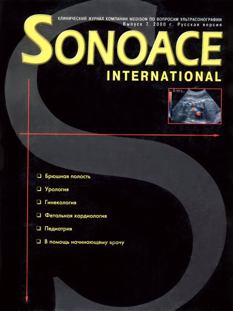 Журнал SonoAce-International №7