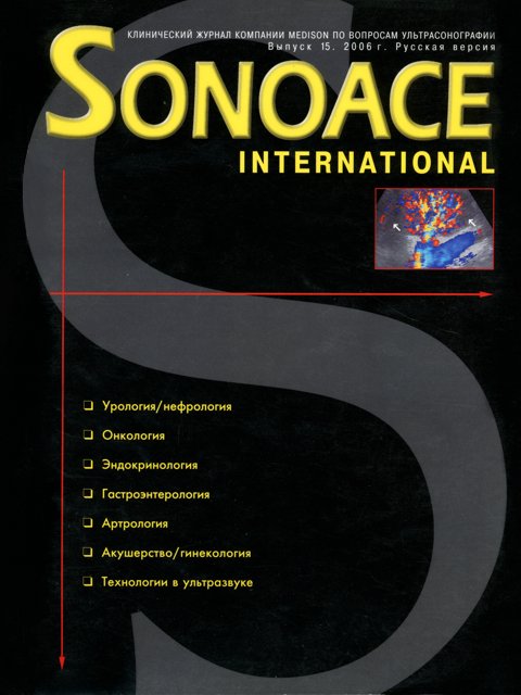 Журнал SonoAce-International №15