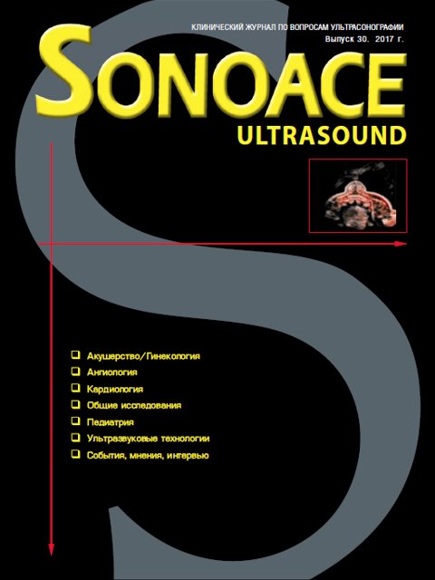 Журнал SonoAce-Ultrasound №30