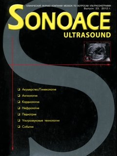 SonoAce-Ultrasound №23