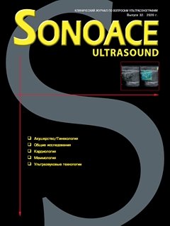 SonoAce-Ultrasound №32