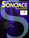 ����������� ������ ''SonoAce-Ultrasound''