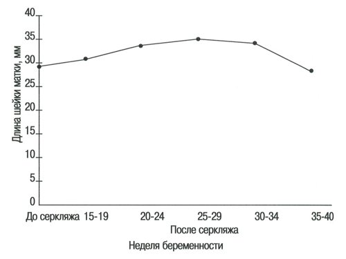 Номограмма - длина шейки матки в группе беременных с высоким риском до и после проведения серкляжа