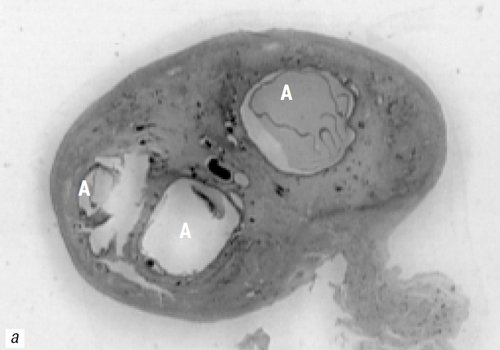 Гистологическая картина: яичник с растущими (А) фолликулами