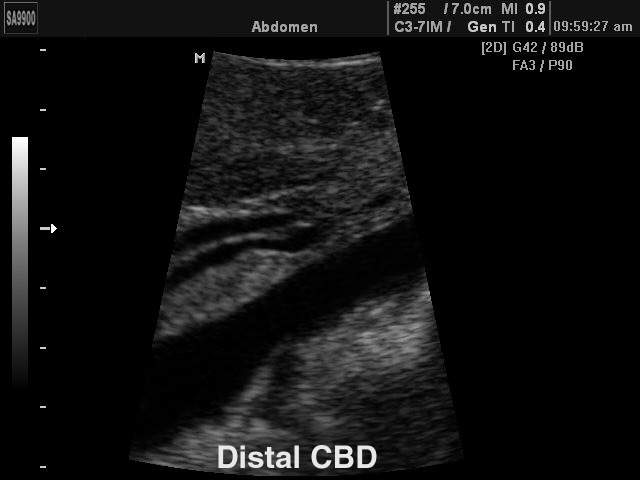 Liver - distal common bile duct, B-mode (echogramm №157)