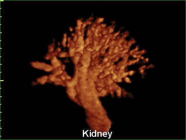 Kidney vessels, power doppler, 3D (echogramm №170)