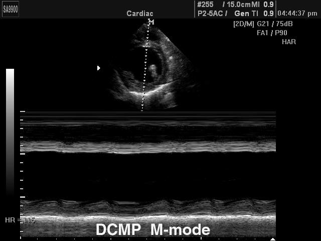 Cardiomyopathy, M-mode (echogramm №178)