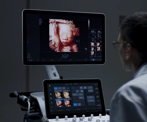 УЗИ сканер Samsung W10