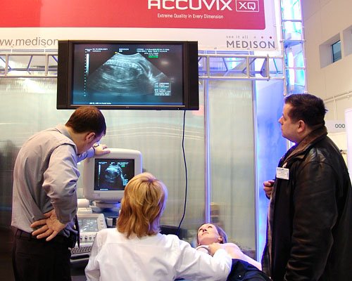 Демонстрация сканера Accuvix - пренатальная диагностика (на экране двухмерная проекция плода)