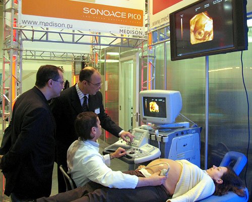 Демонстрация сканера Accuvix - пренатальная диагностика (на экране трехмерное изображение плода)