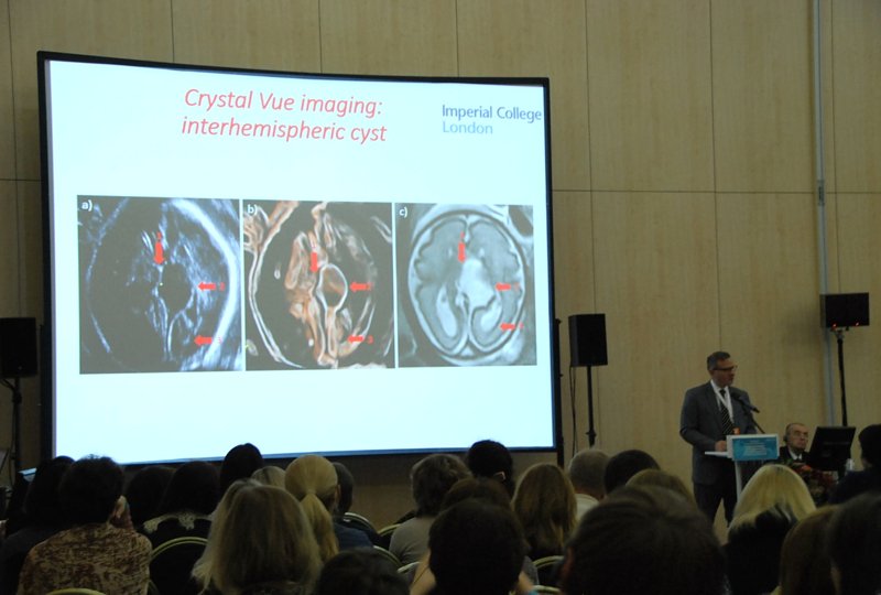 Доктор Christoph Lees - применение технологии Crystal Vue Flow для диагностики головного мозга плода