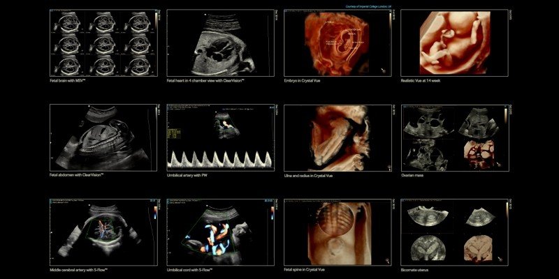 Атлас УЗИ / Atlas of ultrasound images