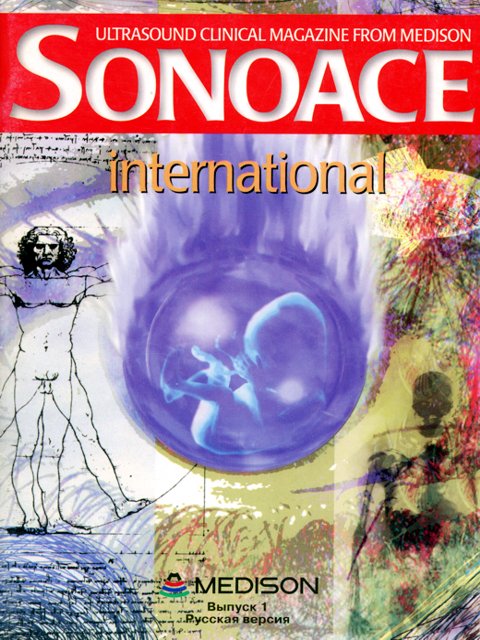 Журнал SonoAce-International №1