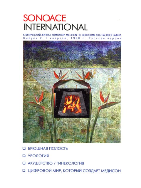 Журнал SonoAce-International №2
