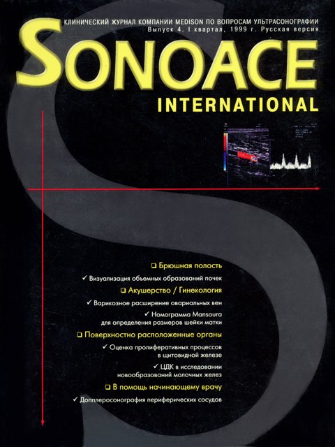 Журнал SonoAce-International №4