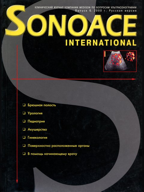 Журнал SonoAce-International №6