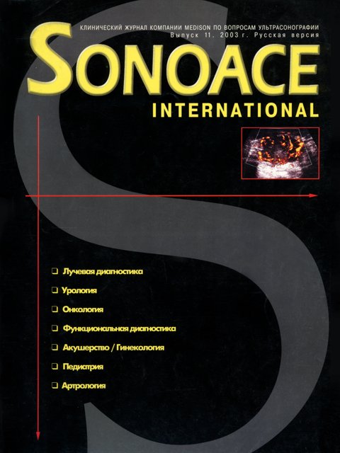 Журнал SonoAce-International №11
