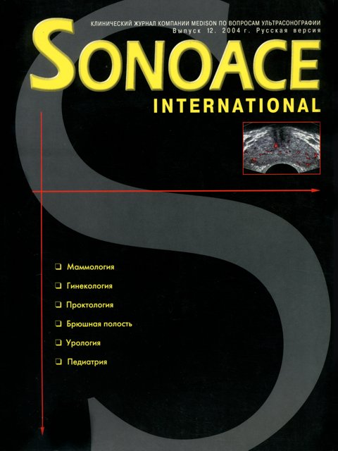 Журнал SonoAce-International №12