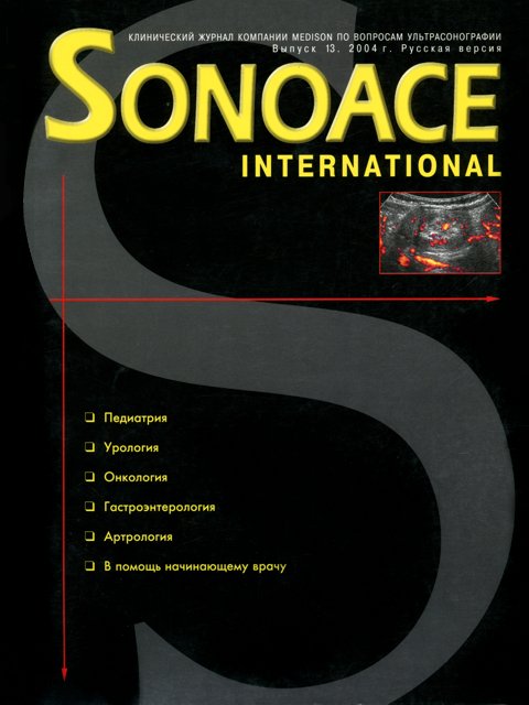 Журнал SonoAce-International №13