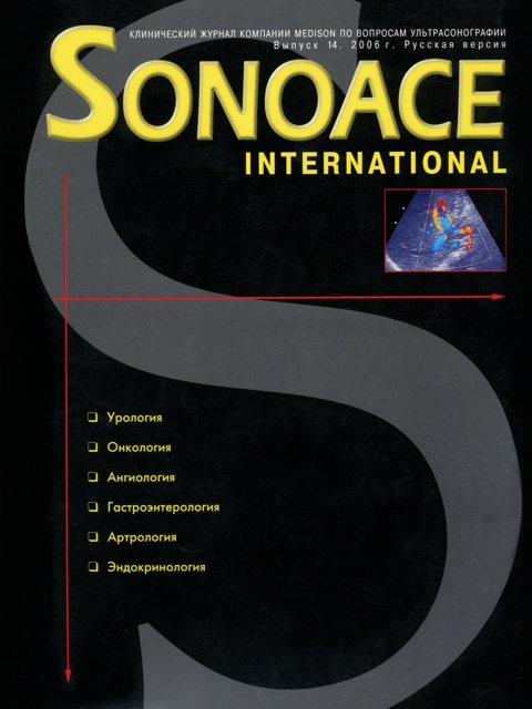 Журнал SonoAce-International №14