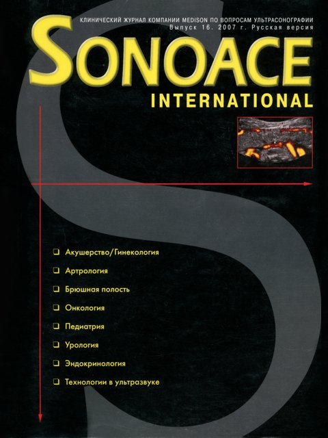 Журнал SonoAce-International №16
