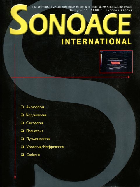 Журнал SonoAce-International №17