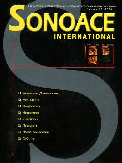 Журнал SonoAce-International №18
