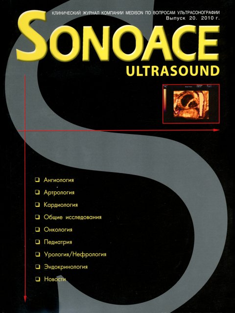 Журнал SonoAce-Ultrasound №20