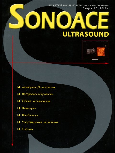 Журнал SonoAce-Ultrasound №25
