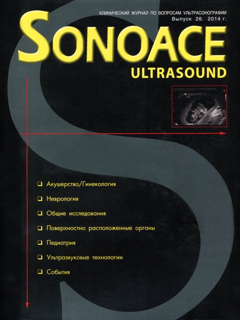 Журнал SonoAce-Ultrasound №26