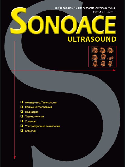 SonoAce Ultrasound №31 - журнал по ультрасонографии, 2018 г