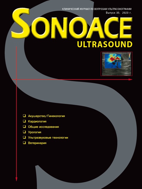 Журнал SonoAce-Ultrasound №35