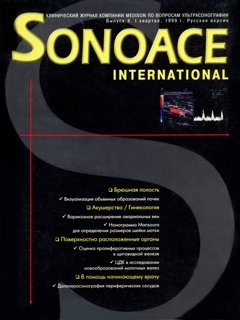 SonoAce-International №4