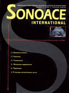 SonoAce-International №7