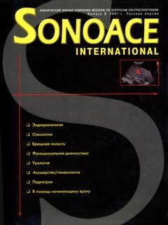 SonoAce-International №8