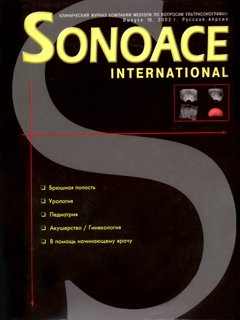 SonoAce-International №10