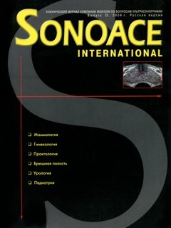 SonoAce-International №12