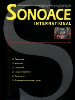SonoAce-International №13