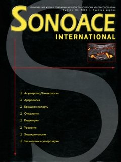 SonoAce-International №16