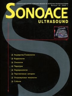 SonoAce-Ultrasound №19