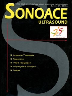 SonoAce-Ultrasound №21