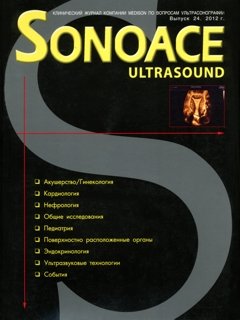 SonoAce-Ultrasound №24