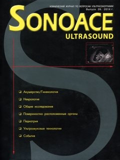 SonoAce-Ultrasound №26