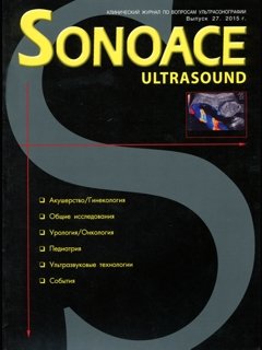 SonoAce-Ultrasound №27