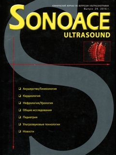 SonoAce-Ultrasound №29