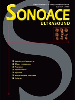 SonoAce-Ultrasound №31