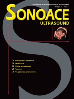 SonoAce-Ultrasound №34