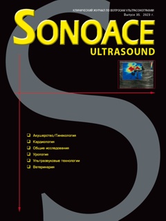 SonoAce-Ultrasound №35