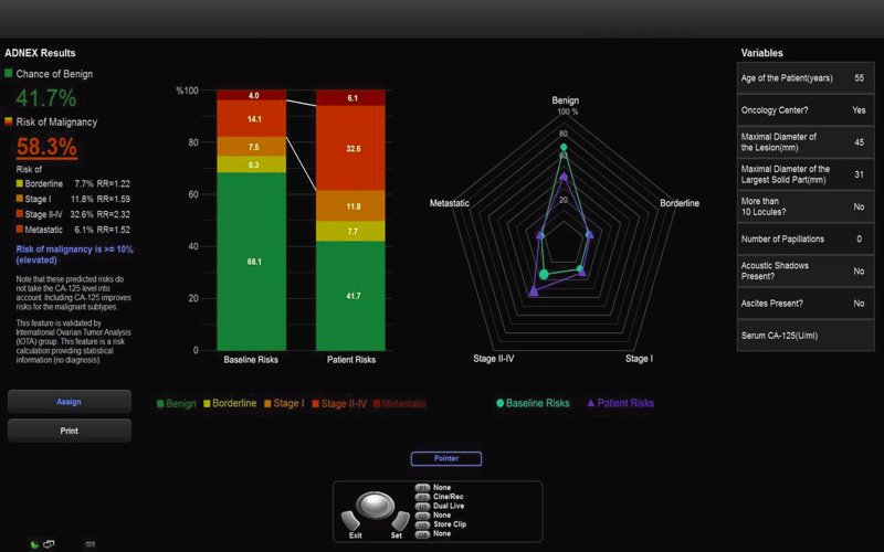 Iota-Adnex - скриншот программы оценки риска опухолей яичника на УЗ-сканере WS80A