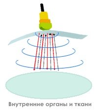 Традиционная методика ультразвукового сканирования